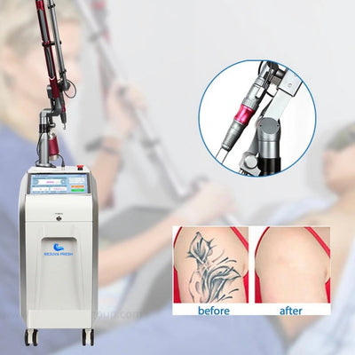 Luna Ink Pro Laser Tattoo Removal Machine