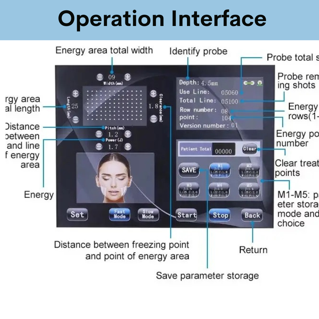 9D Face Lifting HIFU Machine