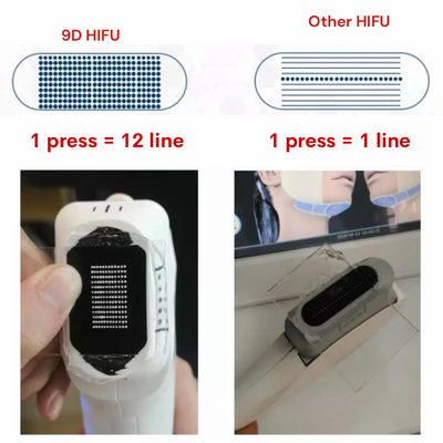 Replacement Cartridge for 9D Face Lifting HIFU Machine