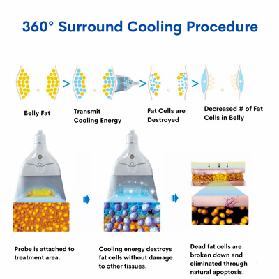 Freezing Attachment for 360 Degrees Cryo Machine